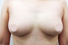 �o�X�g�A�b�v�{�p�O