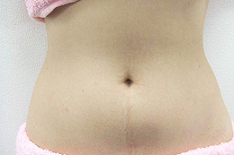 �E�F�X�g�{�p�O